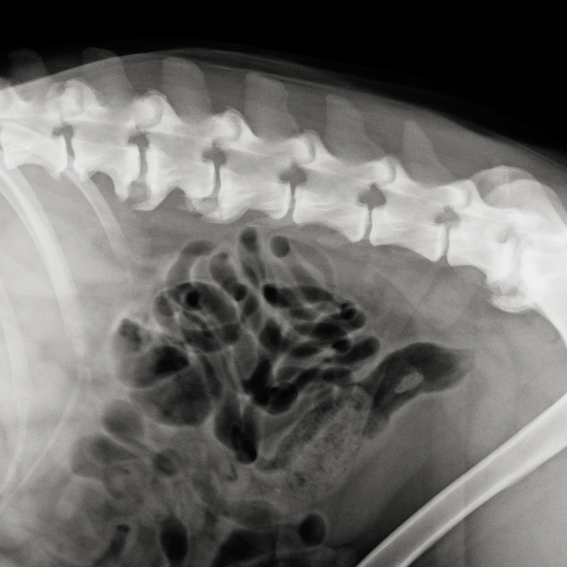 Spondylose